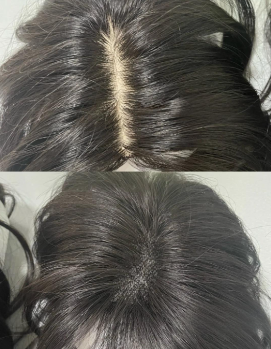 Comparison of wig materials